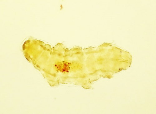 最強生物？「クマムシを探せ！」